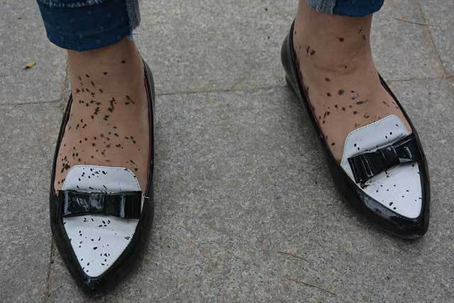 女子遭沥青枪喷沥青,双方各执一词赔偿谈不拢